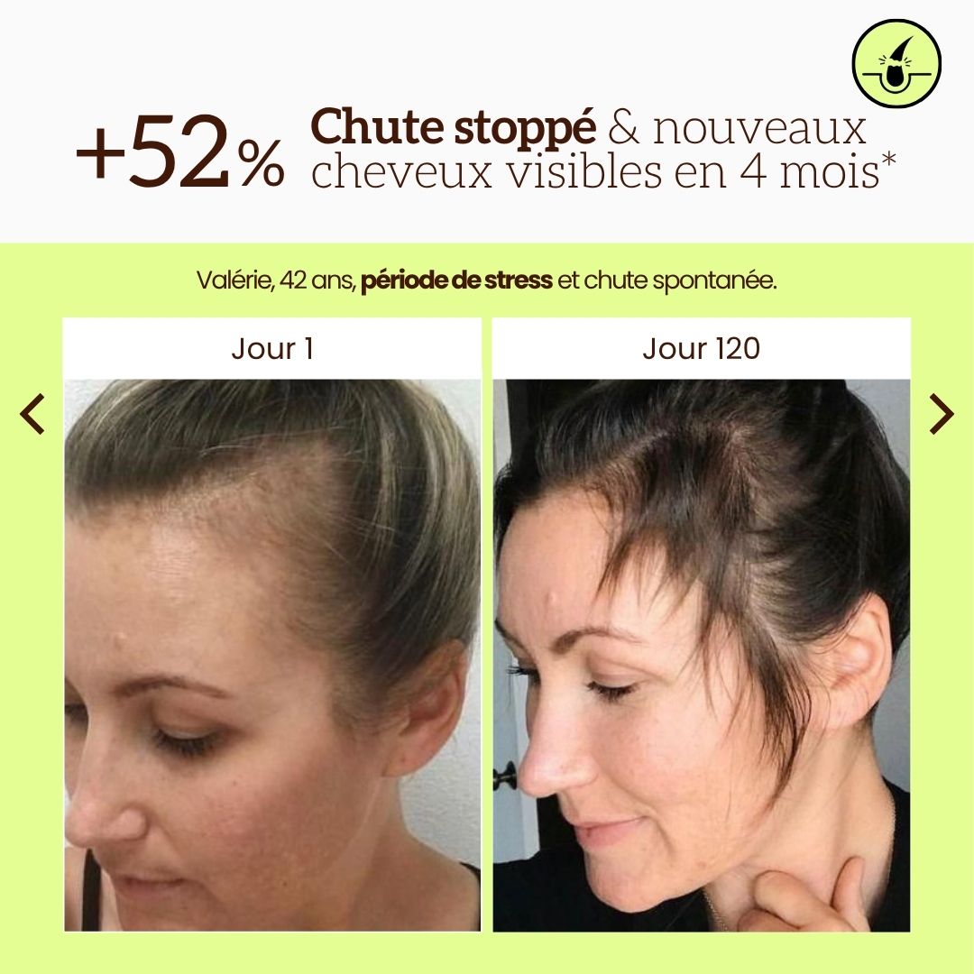 Shampoing Anti-chute & Volume au Romarin